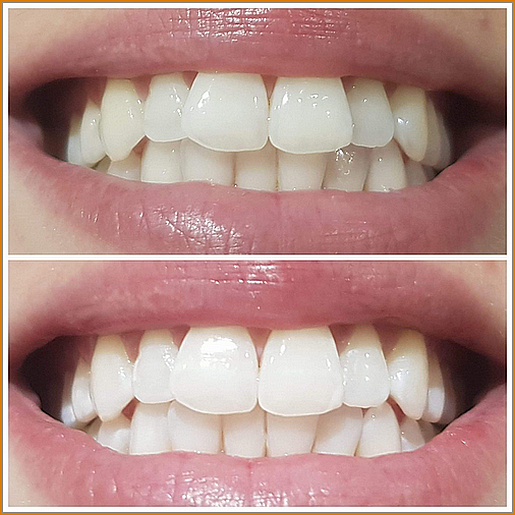 IMG-1119-1536x1536 IMG-1119-1536x1536