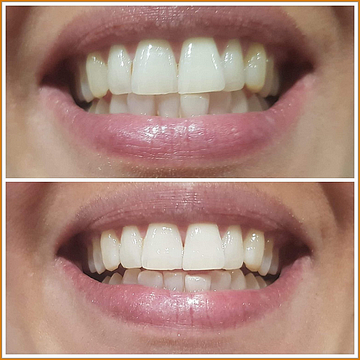 IMG-1121-1536x1536 IMG-1121-1536x1536